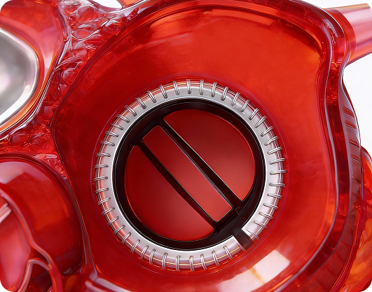 Valvular Repair and Replacement